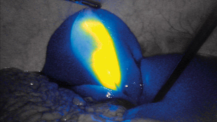 FI intensity – 3D Fluorescence Imaging technology