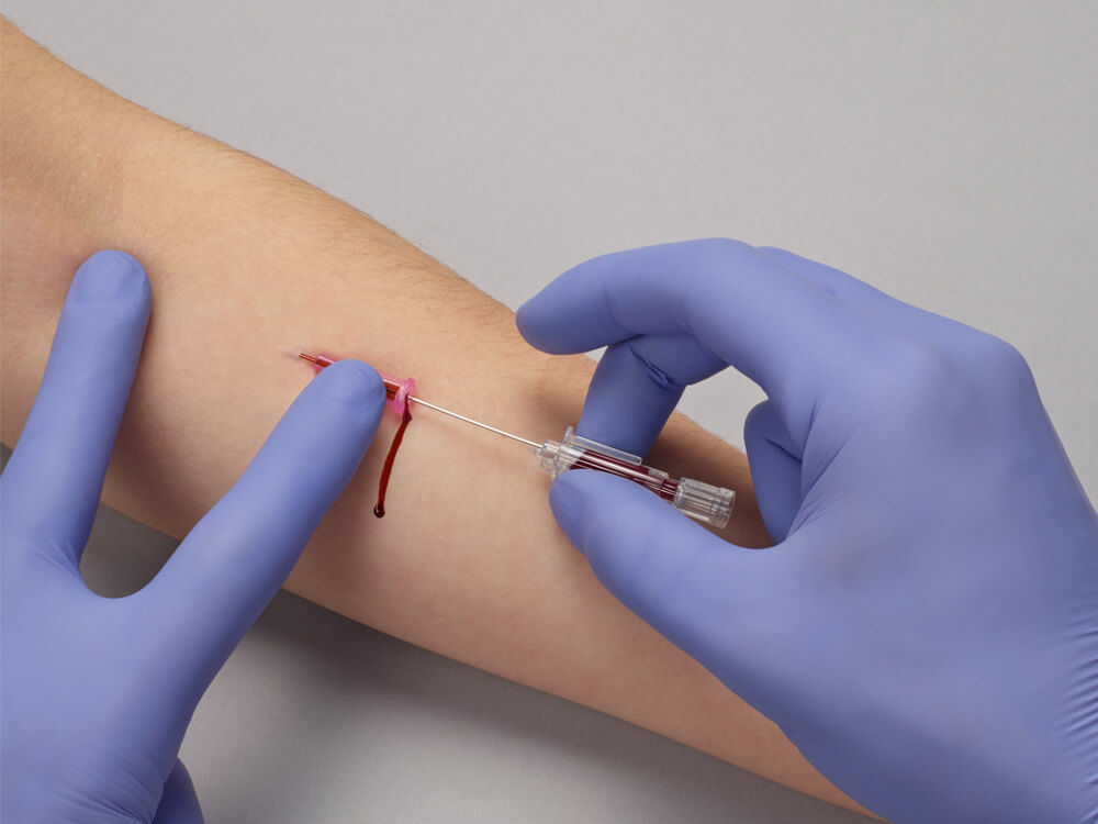 blood leak during blood withdrawal