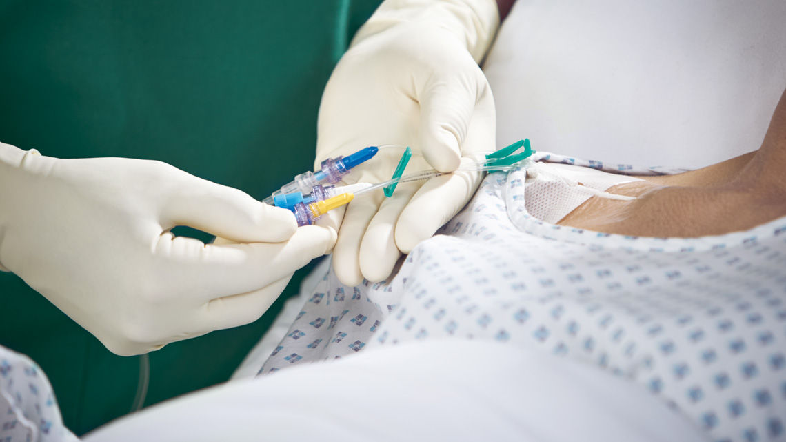 The healthcare worker is adjusting enteral and parenteral nutrition products to the patient through tubes