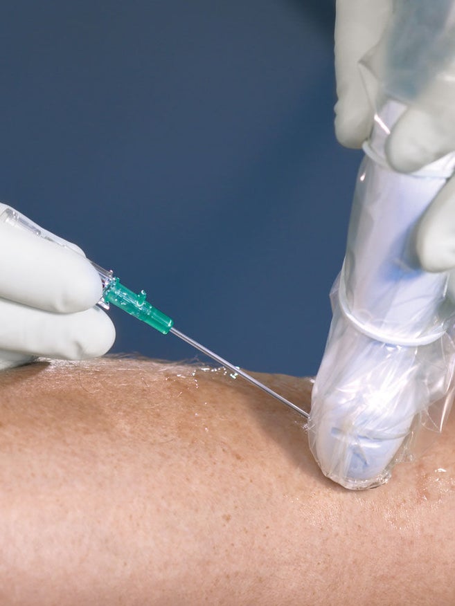 Hand in white glove holds green cannula on arm with transparent gel. Other hand in white glove holds ultrasound probe with transparent protective cover fixed with white rubber ring.
