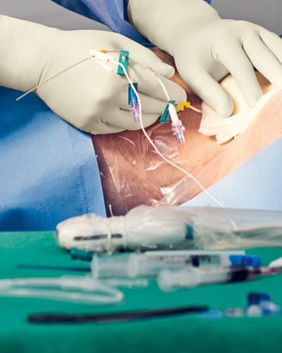 Hands of a medical worker connect central venous access devices to the patient