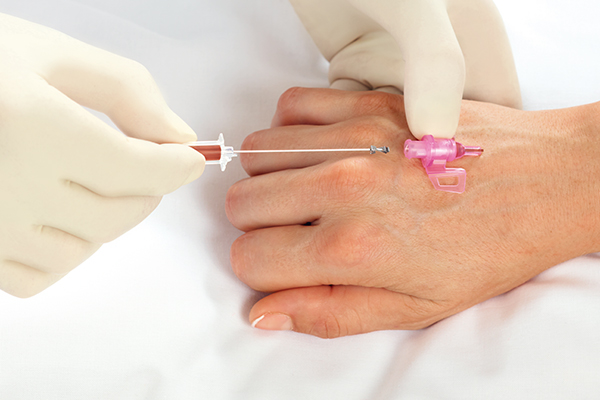 The hands of a healthcare professional, wearing white gloves, are carefully taking blood from the patient’s arm using a catheter